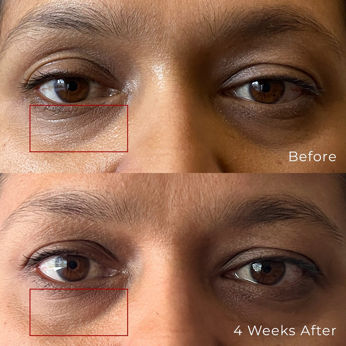 Multi Peptide Hydro Eye Gel